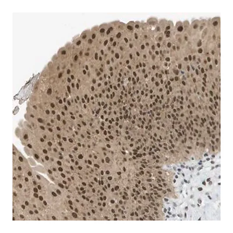 Merck Anti-ARID1B antibody produced in rabbit