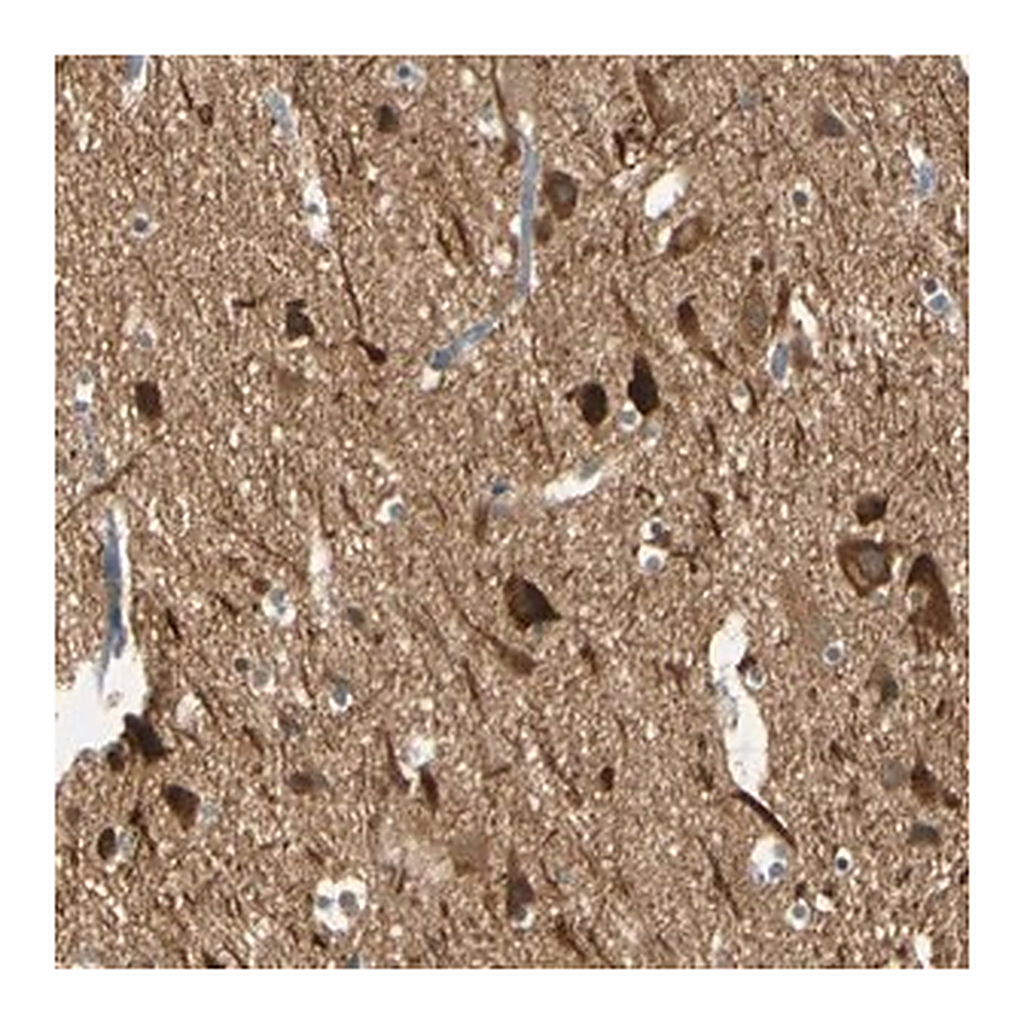 Merck Anti-MAGI3 antibody produced in rabbit