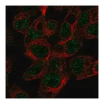 Merck Anti-ABCG5 antibody produced in rabbit