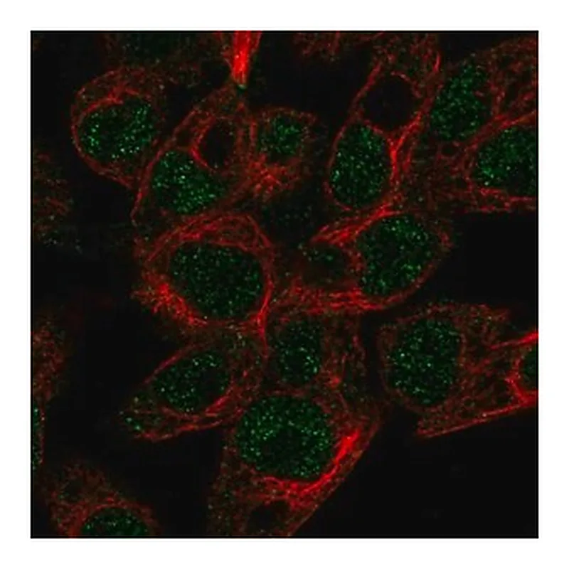 Merck Anti-ABCG5 antibody produced in rabbit
