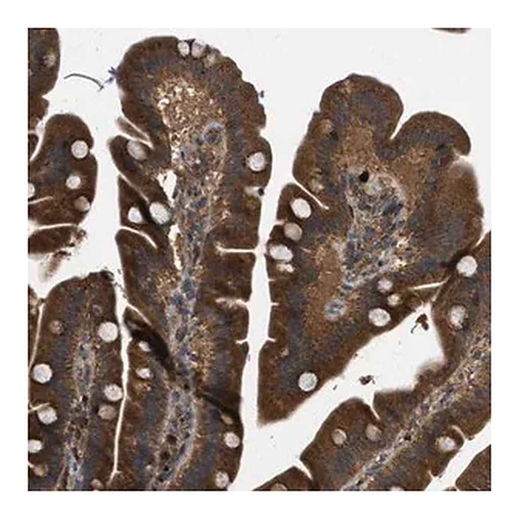 Merck Anti-KIAA0430 antibody produced in rabbit