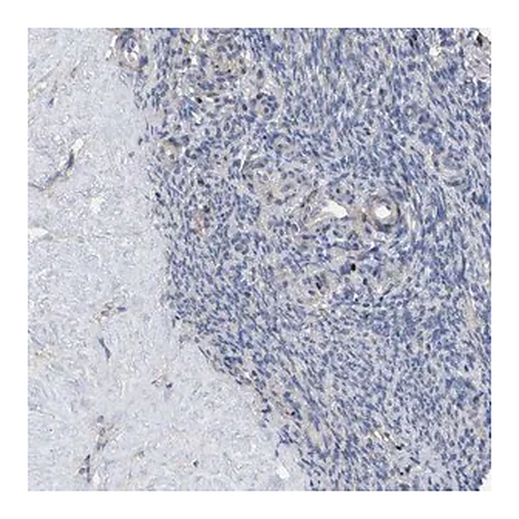 Merck Anti-HTR1A antibody produced in rabbit