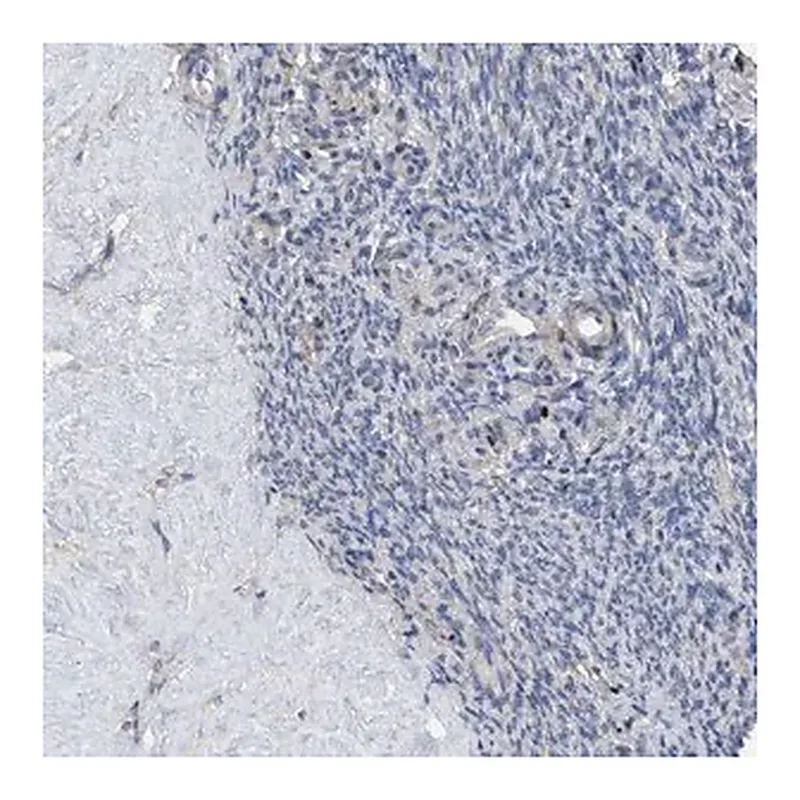 Merck Anti-HTR1A antibody produced in rabbit