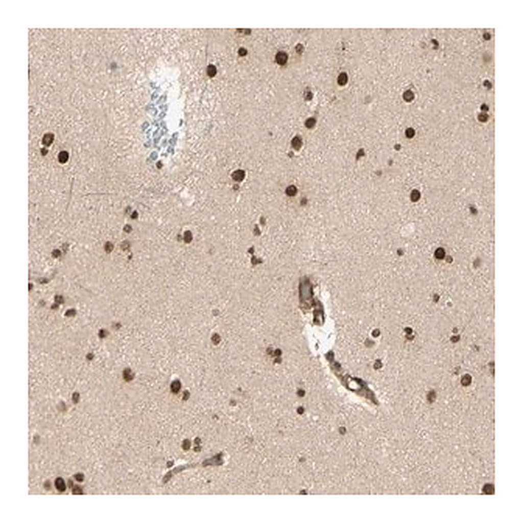 Merck Anti-ZMYM6 antibody produced in rabbit