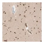 Merck Anti-ZMYM6 antibody produced in rabbit