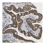 Merck Anti-TMEM223 antibody produced in rabbit