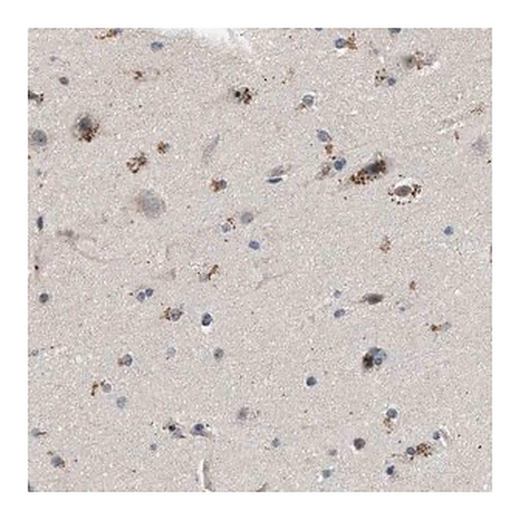 Merck Anti-PDP1 antibody produced in rabbit