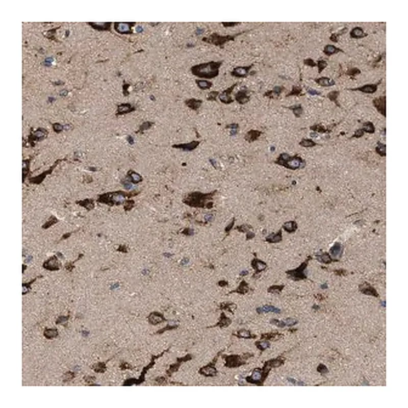 Merck Anti-IL1RL2 antibody produced in rabbit