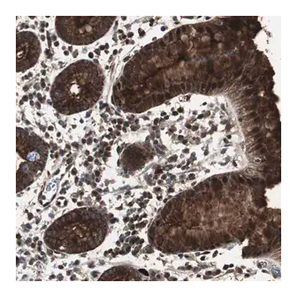 Merck Anti-MUC1 antibody produced in rabbit