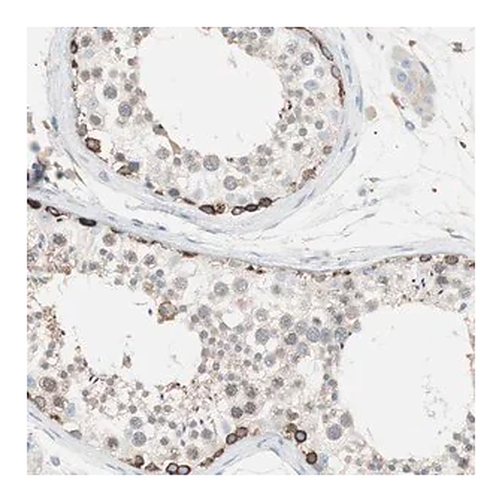 Merck Anti-SLC27A4 antibody produced in rabbit