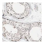 Merck Anti-SLC27A4 antibody produced in rabbit