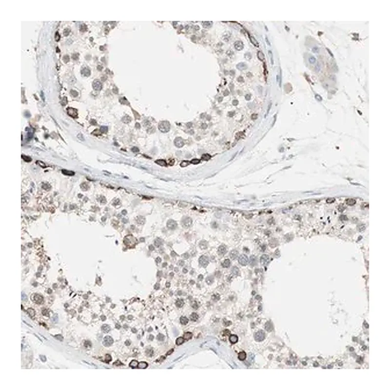 Merck Anti-SLC27A4 antibody produced in rabbit