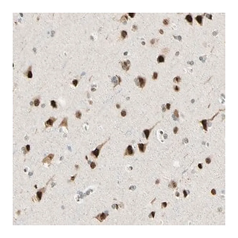Merck Anti-ATXN1 antibody produced in rabbit