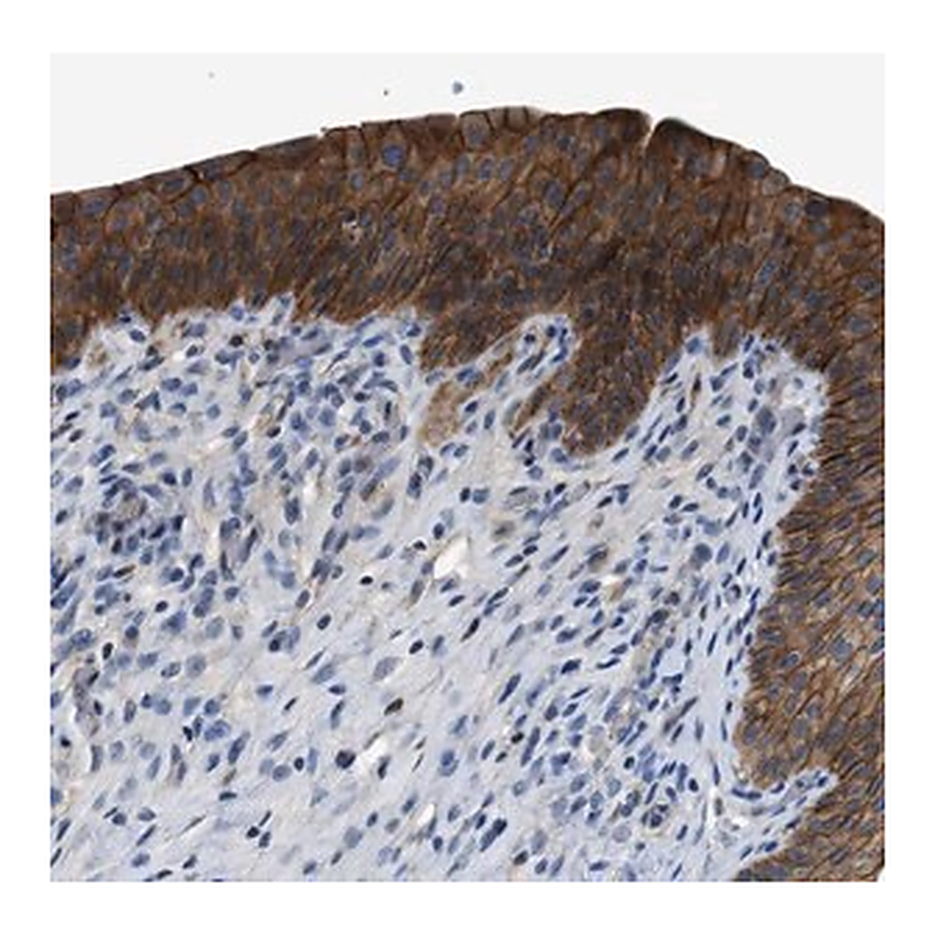 Merck Anti-ZDHHC24 antibody produced in rabbit