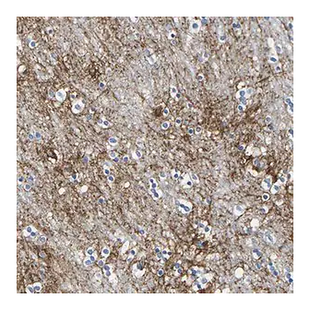 Merck Anti-OTOF antibody produced in rabbit