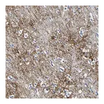 Merck Anti-OTOF antibody produced in rabbit