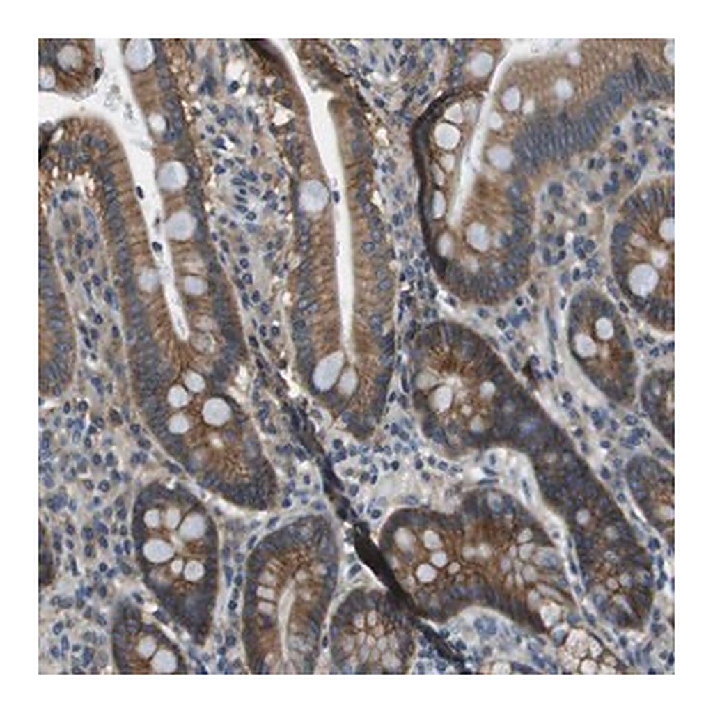 Merck Anti-TMEM51 antibody produced in rabbit