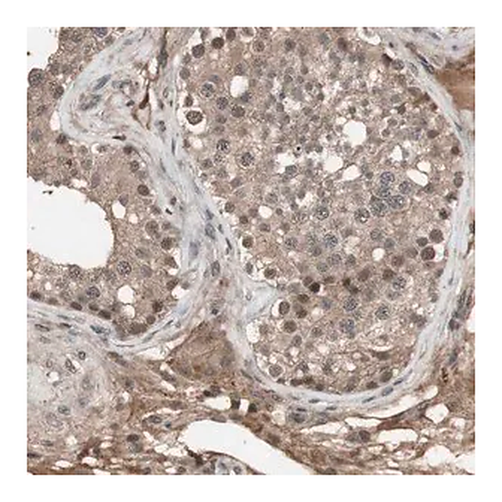 Merck Anti-KANSL1 antibody produced in rabbit