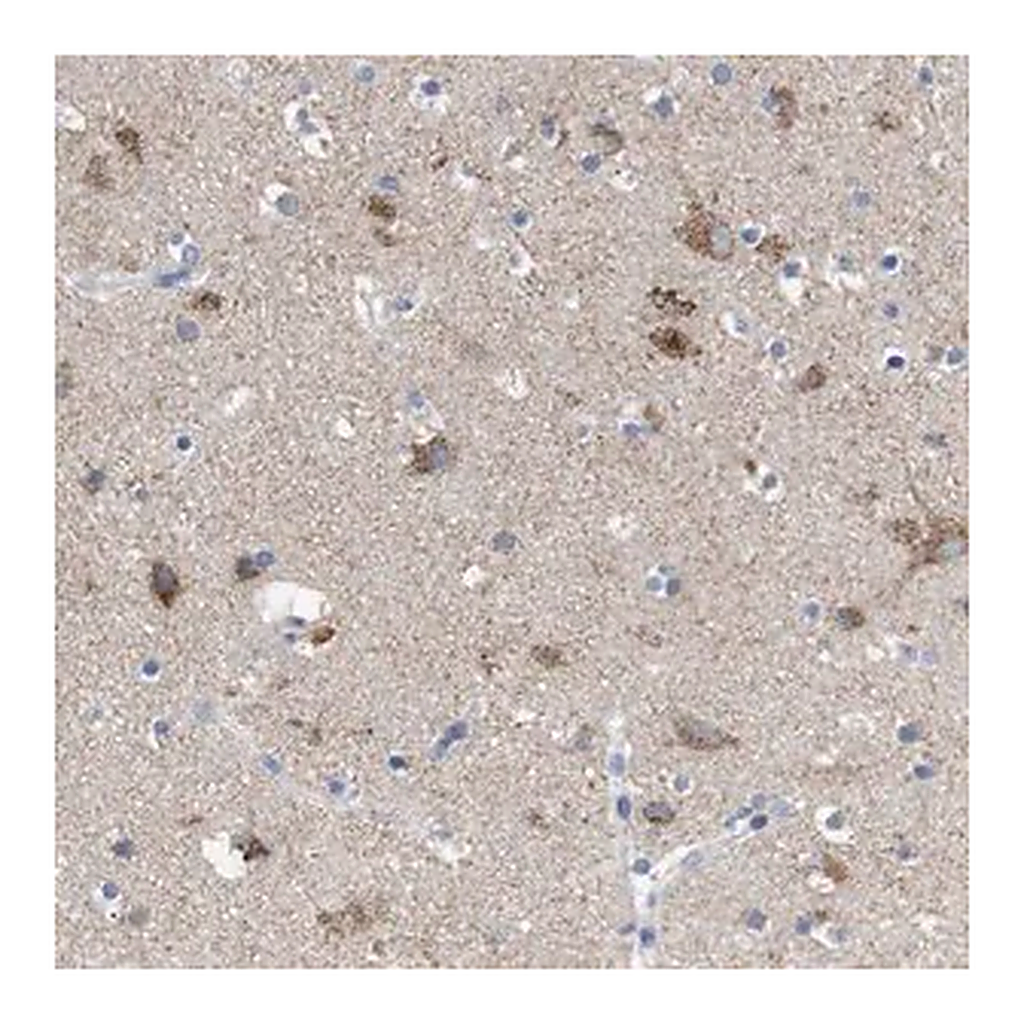 Merck Anti-LRRC55 antibody produced in rabbit