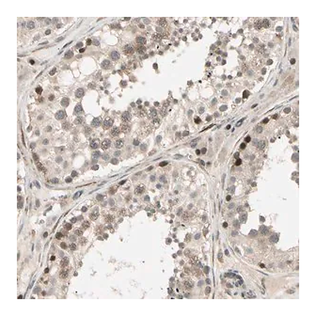 Merck Anti-SVBP antibody produced in rabbit