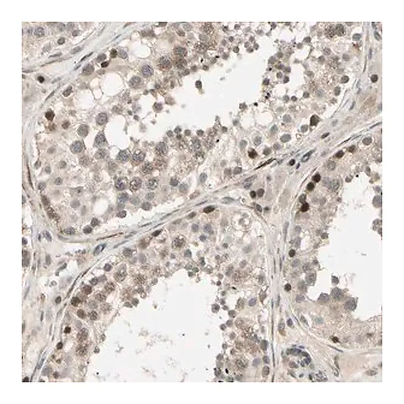 Merck Anti-SVBP antibody produced in rabbit