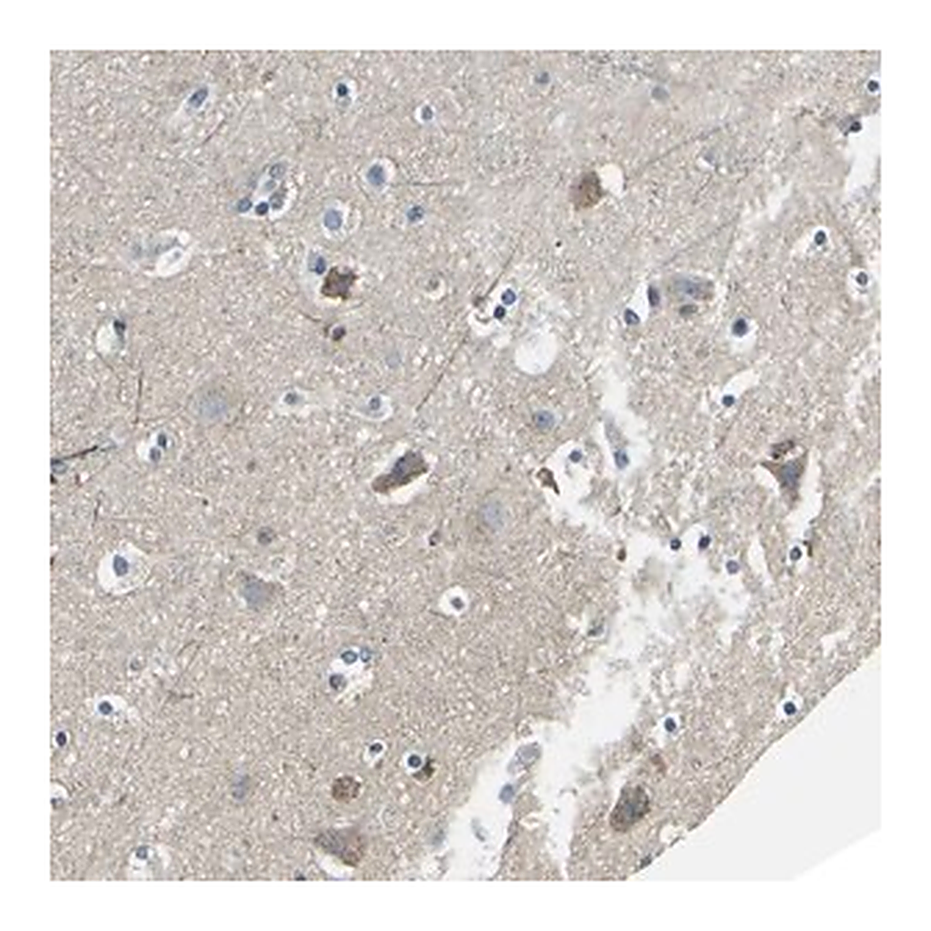 Merck Anti-TMEFF2 antibody produced in rabbit