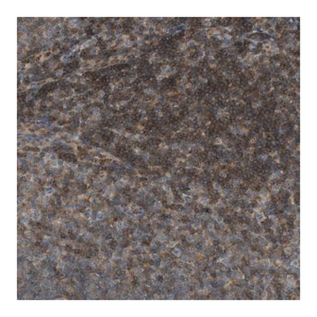 Merck Anti-GRK6 antibody produced in rabbit