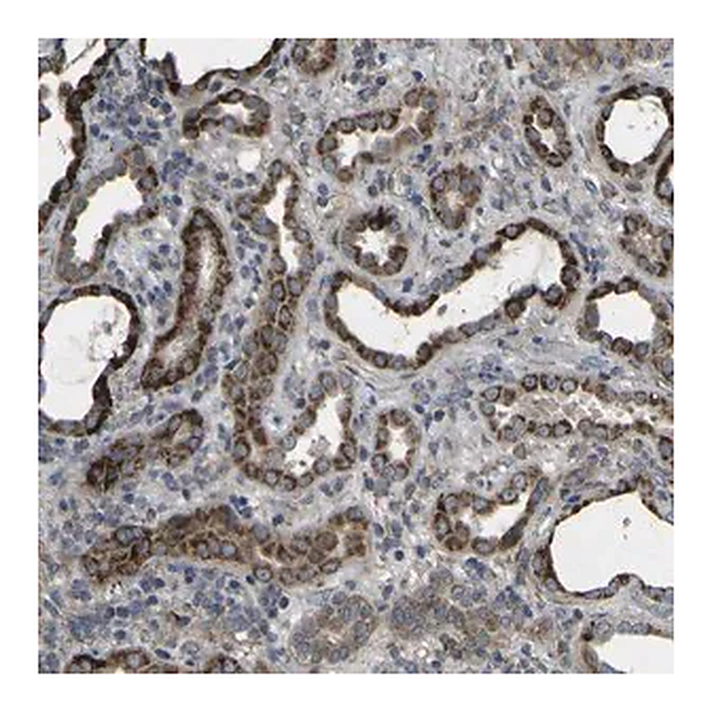 Merck Anti-GPLD1 antibody produced in rabbit
