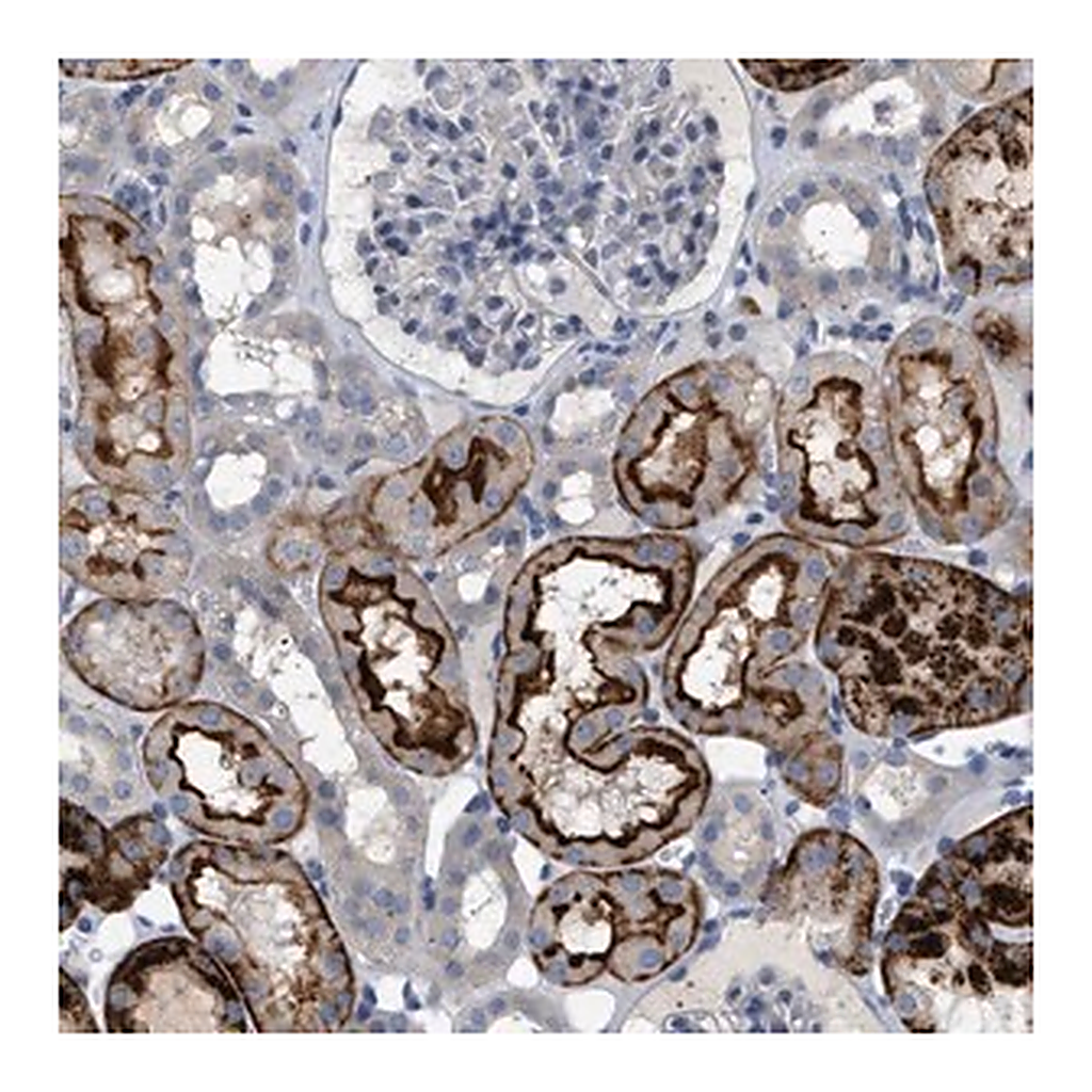 Merck Anti-ADCY10 antibody produced in rabbit