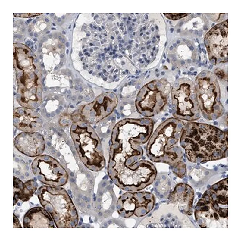 Merck Anti-ADCY10 antibody produced in rabbit