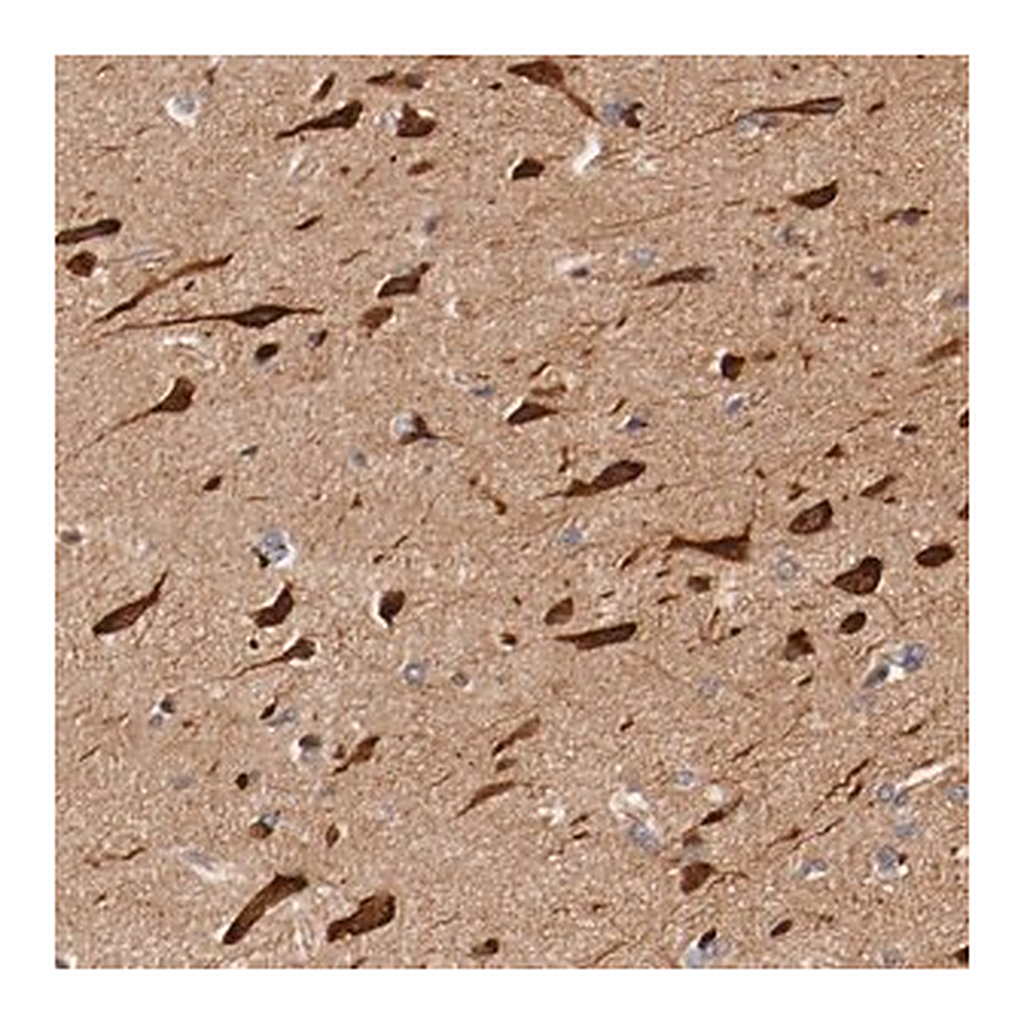 Merck Anti-PITPNM2 antibody produced in rabbit