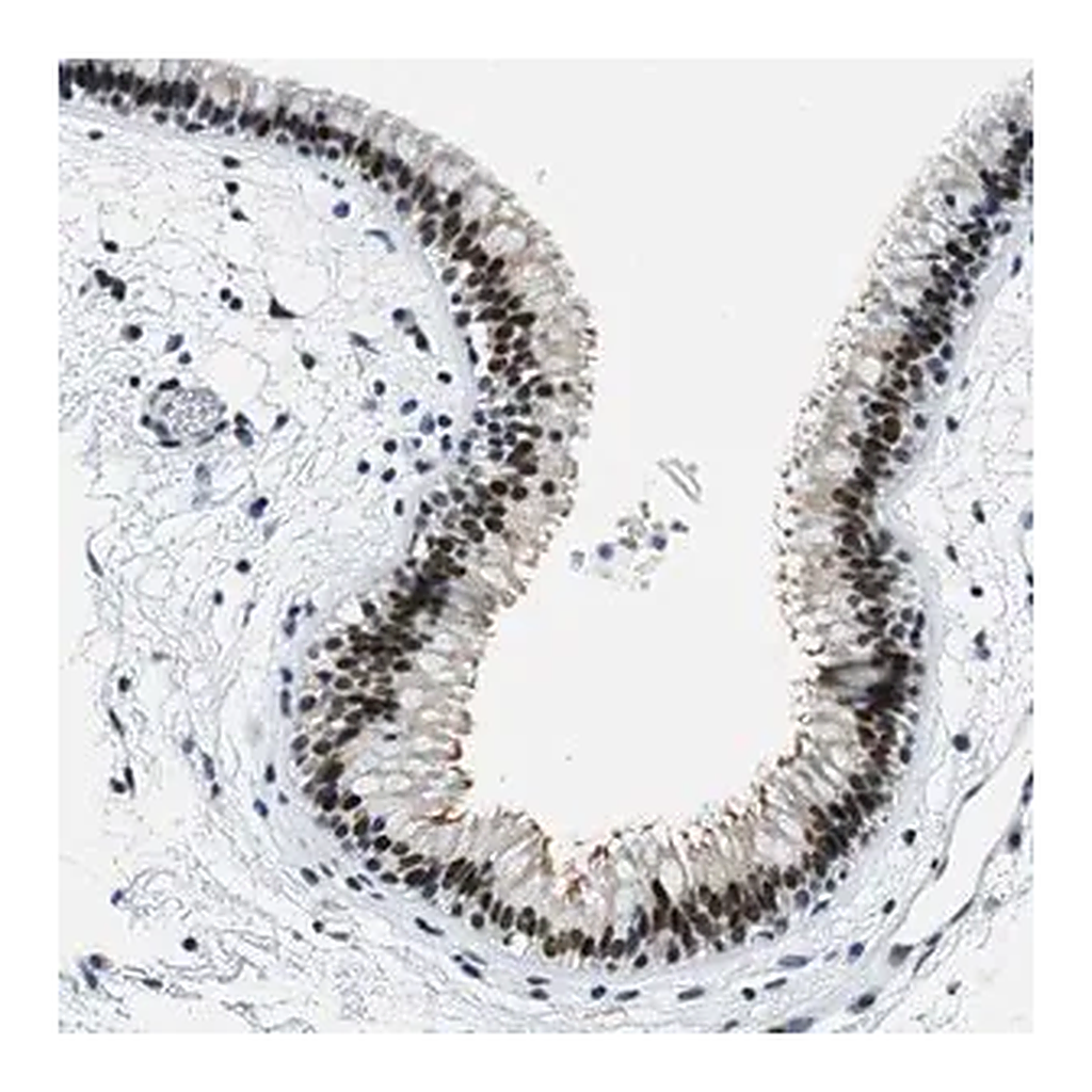 Merck Anti-SSB antibody produced in rabbit