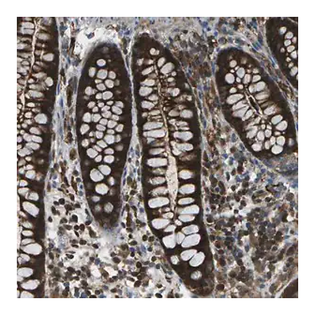 Merck Anti-CDH23 antibody produced in rabbit