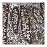 Merck Anti-CDH23 antibody produced in rabbit