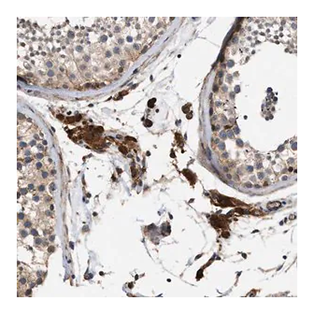 Merck Anti-SLC4A11 antibody produced in rabbit