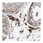 Merck Anti-SLC4A11 antibody produced in rabbit