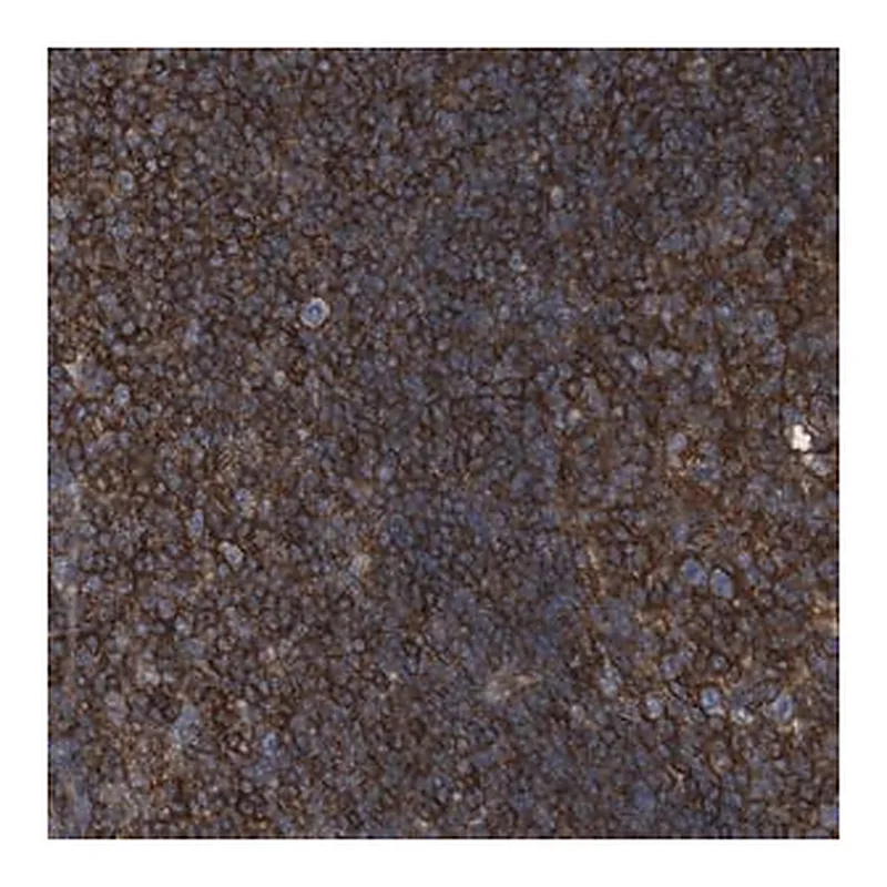 Merck Anti-CCR6 antibody produced in rabbit