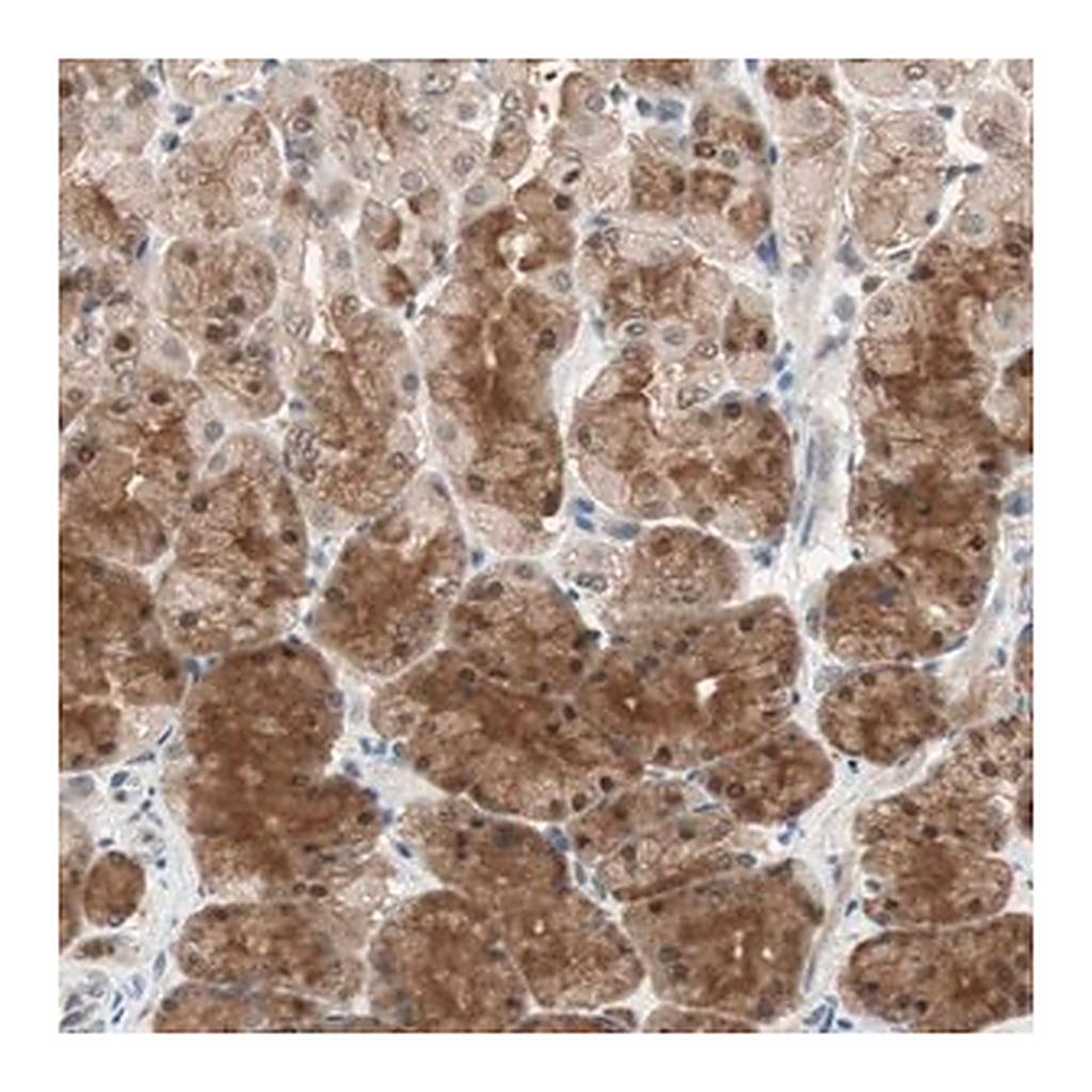 Merck Anti-GART antibody produced in rabbit