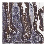 Merck Anti-SPTBN1 antibody produced in rabbit