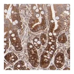 Merck Anti-GART antibody produced in rabbit