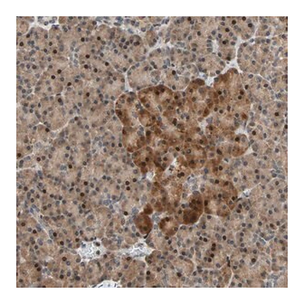 Merck Anti-HECW1 antibody produced in rabbit