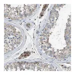 Merck Anti-CLCN2 antibody produced in rabbit