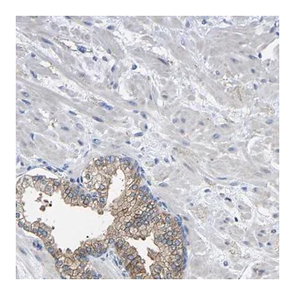 Merck Anti-CMTM1 antibody produced in rabbit