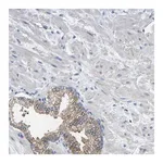 Merck Anti-CMTM1 antibody produced in rabbit