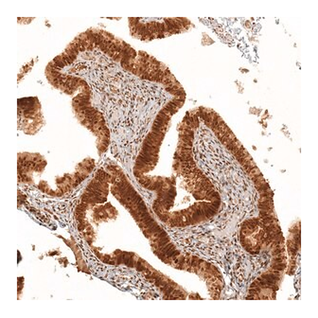 Merck Anti-KIAA1551 antibody produced in rabbit