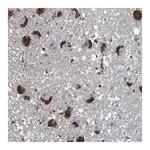 Merck Anti-CYP2W1 antibody produced in rabbit