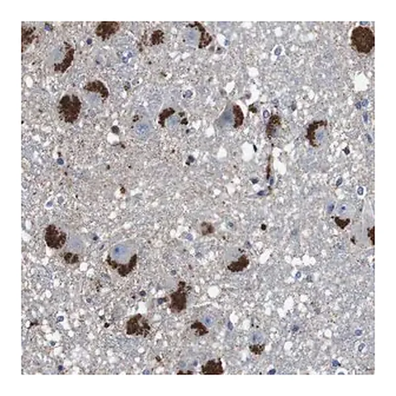 Merck Anti-CYP2W1 antibody produced in rabbit