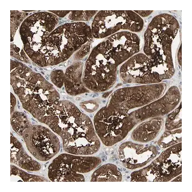 Merck Anti-IGFBP6 antibody produced in rabbit