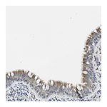 Merck Anti-ZDHHC13 antibody produced in rabbit
