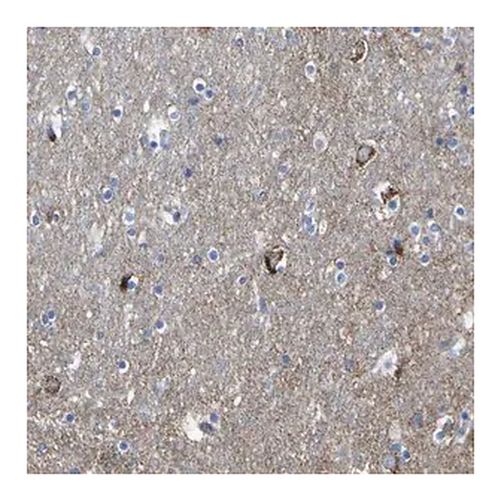 Merck Anti-HK1 antibody produced in rabbit